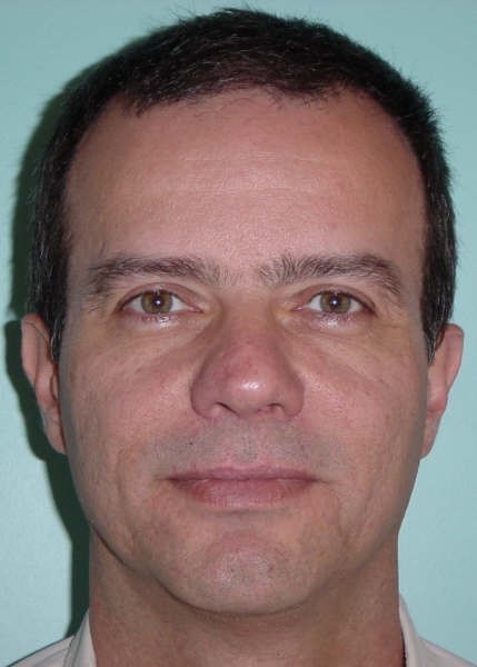 Foto de Dr. Paulo Kharmandayan